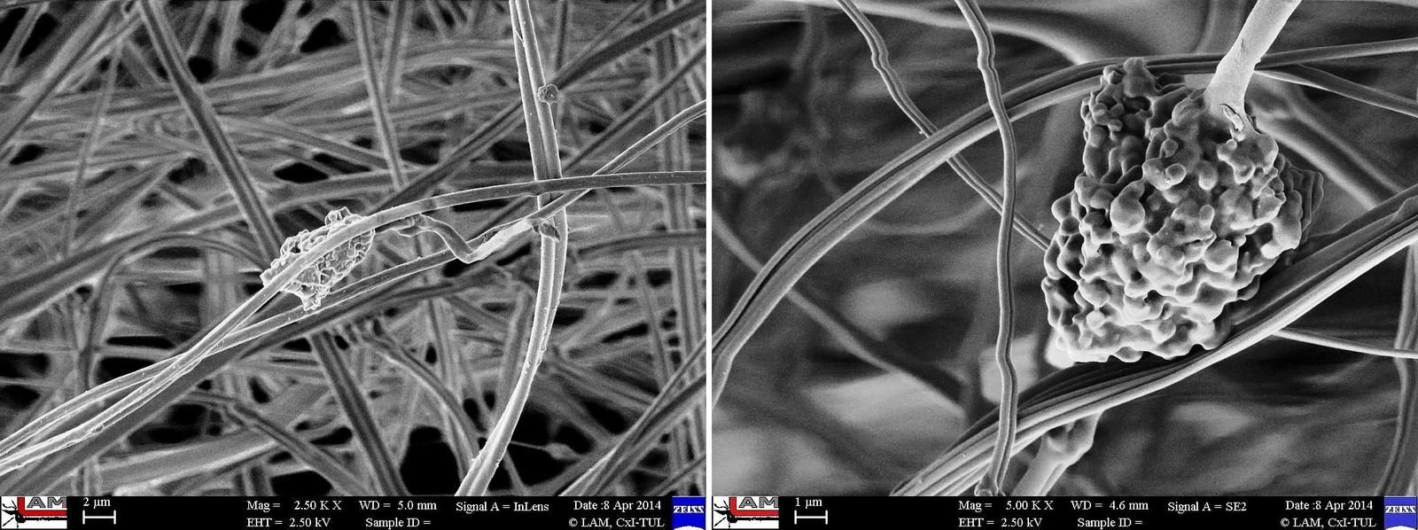 Nanovlákna chránící před rentgenovým zářením
